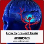 Protecting Your Brain Health: how to prevent brain aneurysm