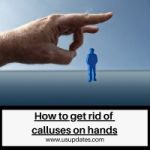 Hand Care 101: How to Get Rid of Calluses Safely and Effectively